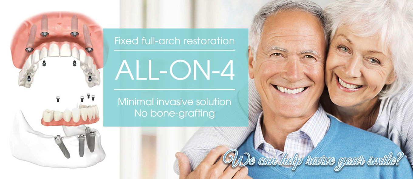 All-On-4 Implant Dentistry